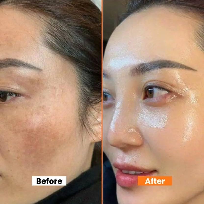 Biocos Dark Spots Correcting Cream