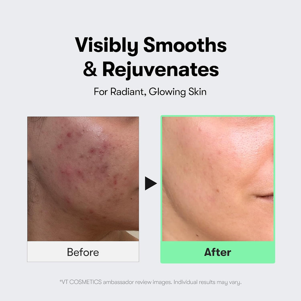 VT Cosmetics Reedle Shot 100 Microneedle Booster Serum 50 ml