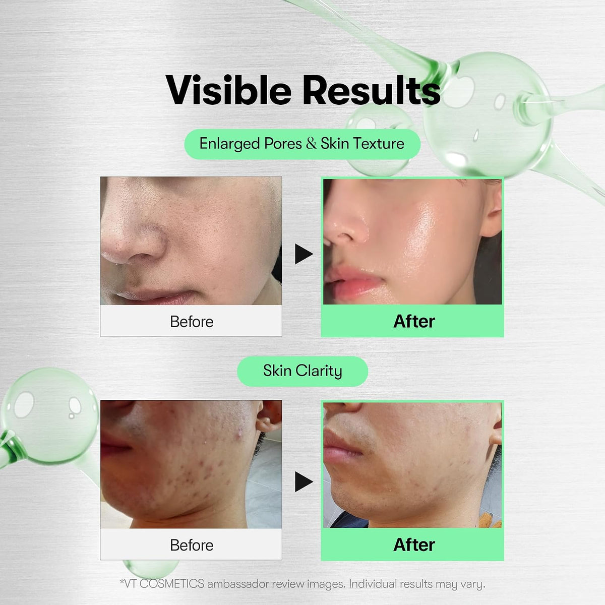 VT Cosmetics Reedle Shot 100 Microneedle Booster Serum 50 ml